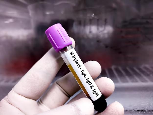 prueba helicobacter pylori guatemala